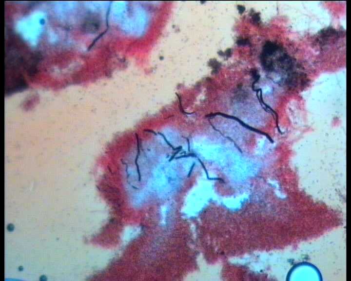 Hydropus atramentosus (Kalchbr.) Kotl. & Pouz.